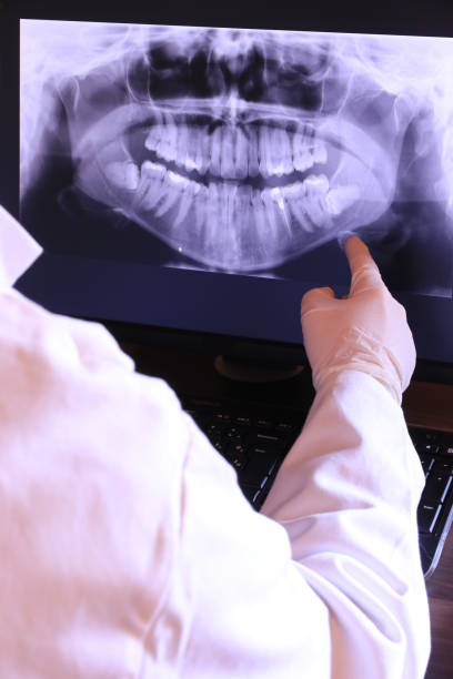 Best Emergency TMJ Treatment in Schnecksville, PA